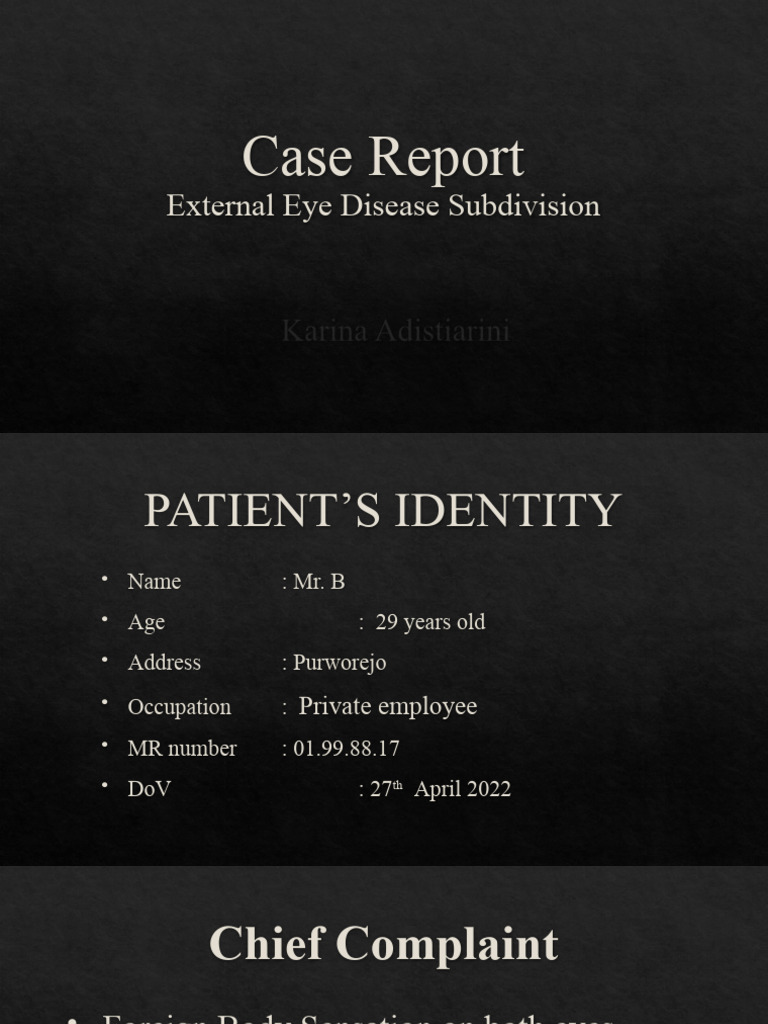 Sjogren Syndrome Pdf Human Eye Medicine