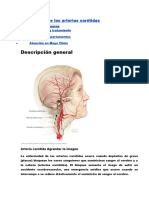 Enfermedad de Las Arterias Carótidas