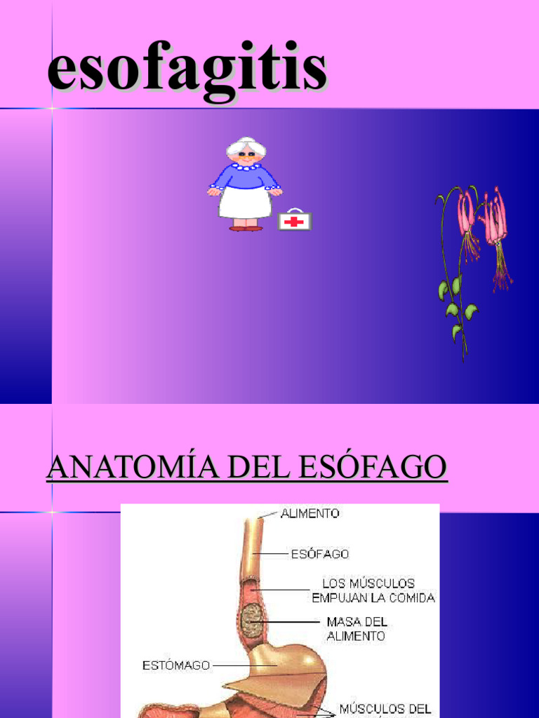Guía Completa sobre la Esofagitis | PDF