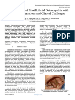 2 Case Reports of Maxillofacial Osteomyelitis With Unique Presentations and Clinical Challenges