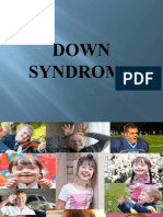 Down Syndrome