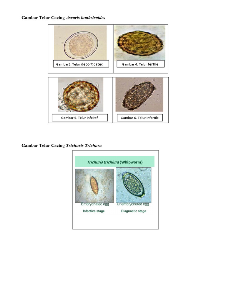 Gambar Telur Cacing Ascaris Lumbricoides | PDF