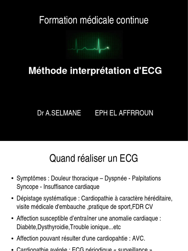 Interprétation de l'ECG et onde Q PDF Électrocardiographie — free download