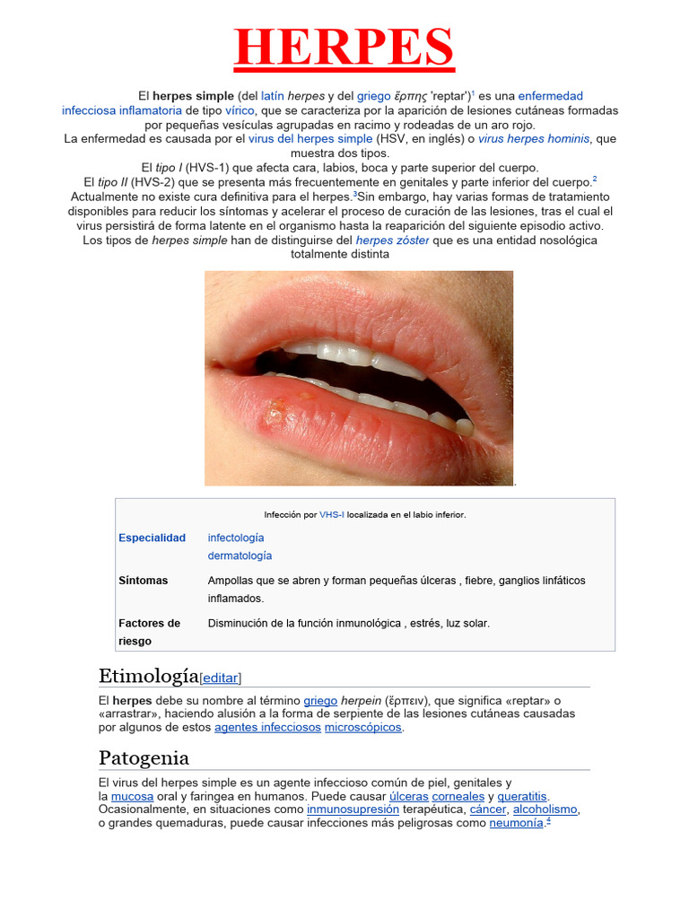  Herpes: Tipos, Síntomas y Tratamientos 