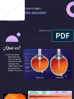 Degeneracion Macular Miopica FLAVIA