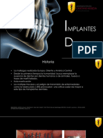 Implantes Dentales - Valeria Salazar