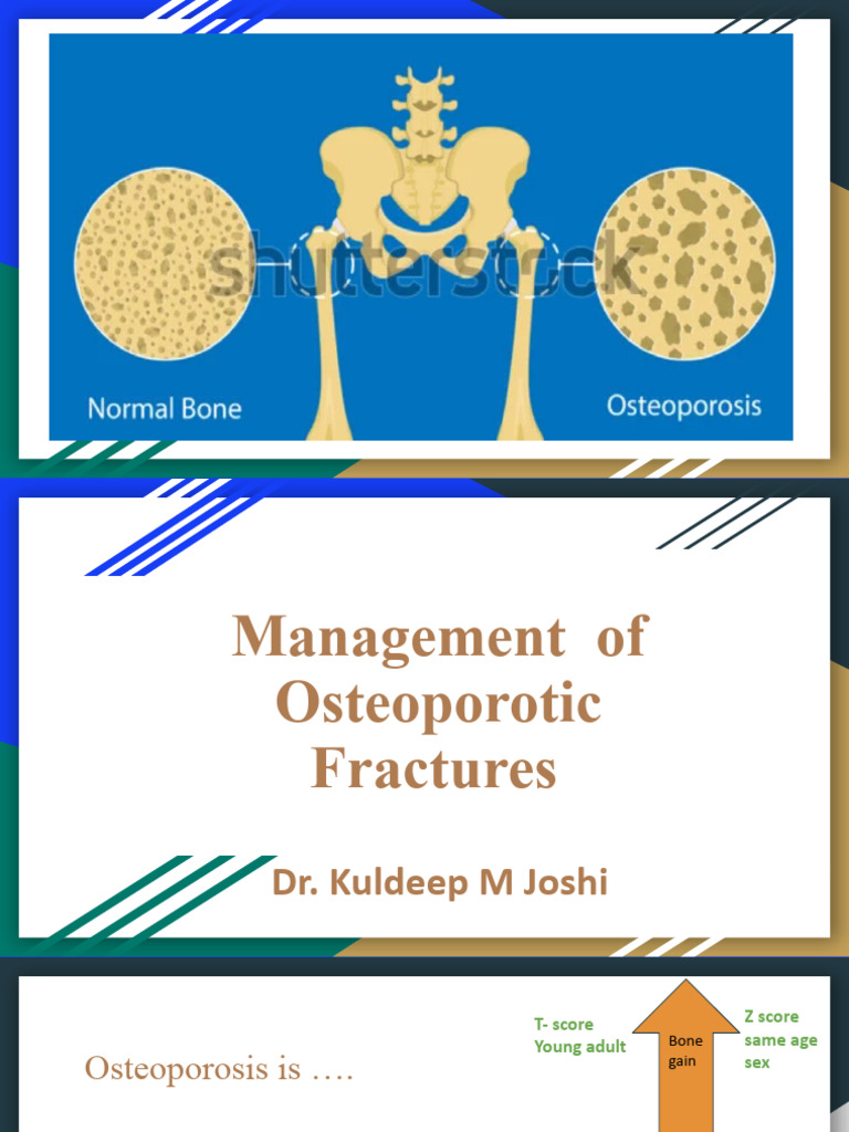 Management of Osteoporotic Fractures | PDF