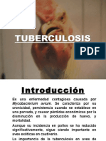 13 Tuberculosis