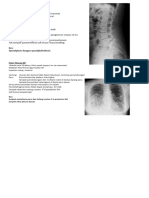 Radiologi Spondilosis Dan Metastase Paru