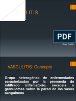 Vasculitis 25-08-16