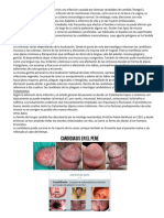 La Candidiasis