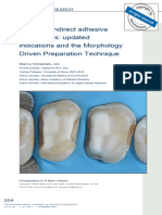 Posterior Indirect Adhesive