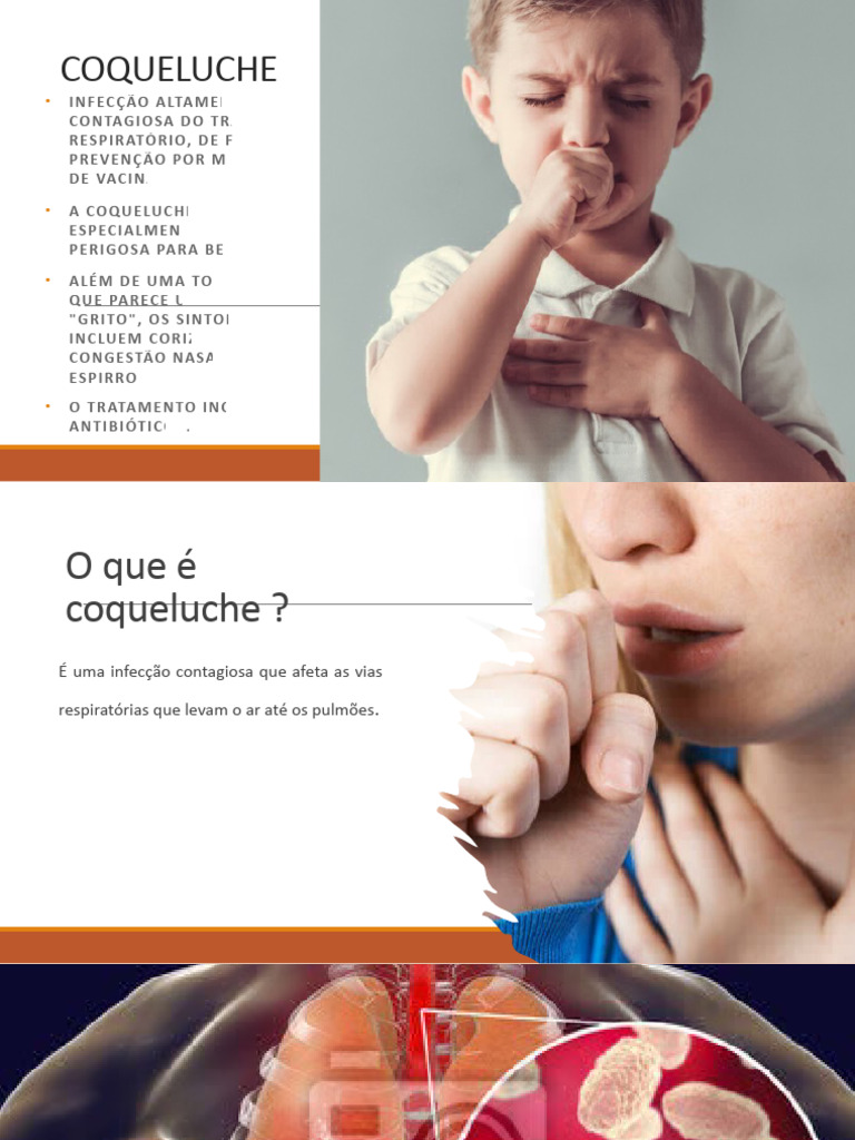 COQUELUCHE | PDF