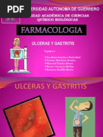 Ulceras y Gastritis