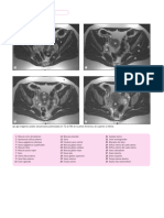 Weir Estudios Pelvis