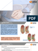 Peritonitis