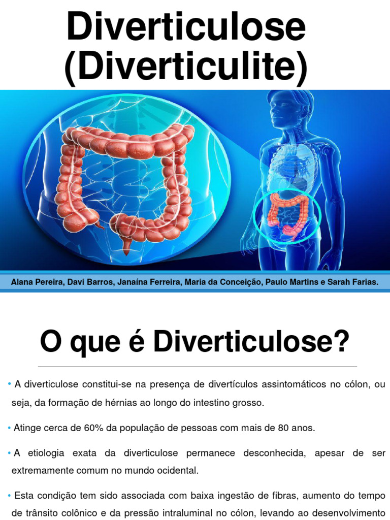 Diverticulose e Diverticulite: Definições e Tratamento | PDF