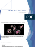 Artritis Reumatoide