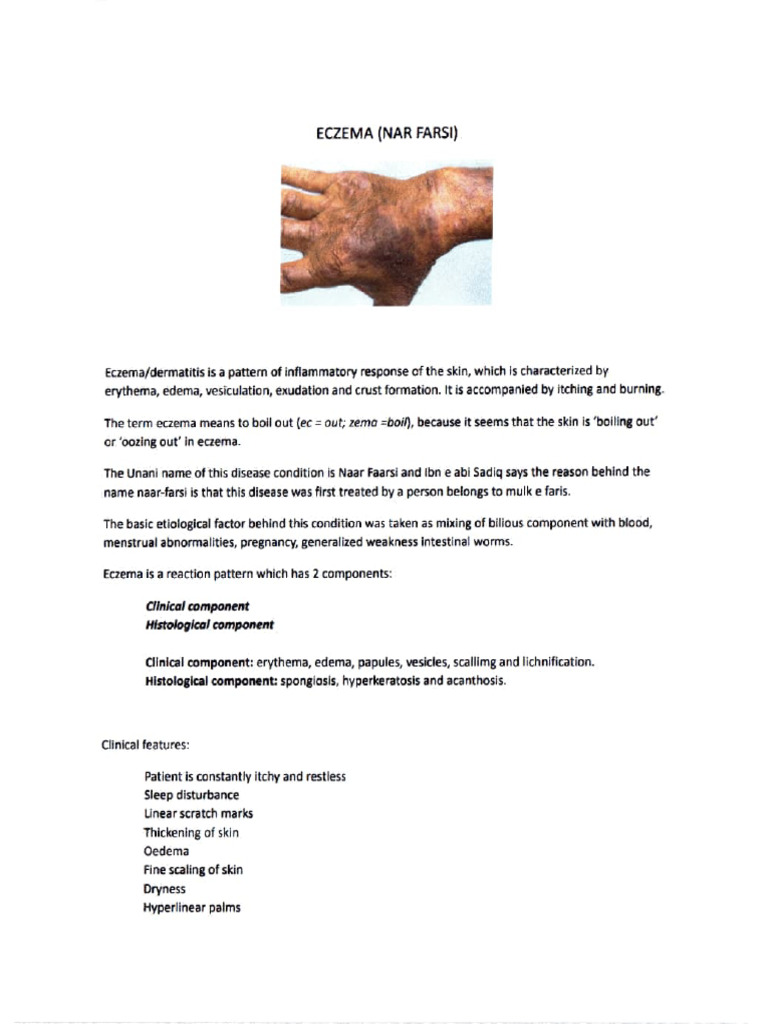 Understanding Eczema: Causes and Treatments | PDF