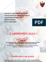 CARDIOMEGALIA