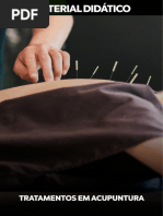 Tratamentos em Acupuntura 2