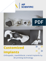 Customized Implants