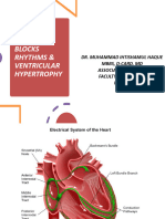 ECGHeart Blocks, Rhythms Ventricular Hypertrophy