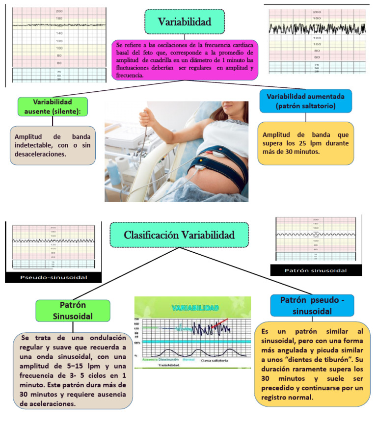 Variabilidad Fetal y Patrones Sinusoidales | PDF