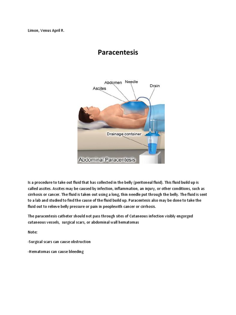 paracentesis | Shock (Circulatory) | Surgery