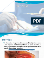 Hernias