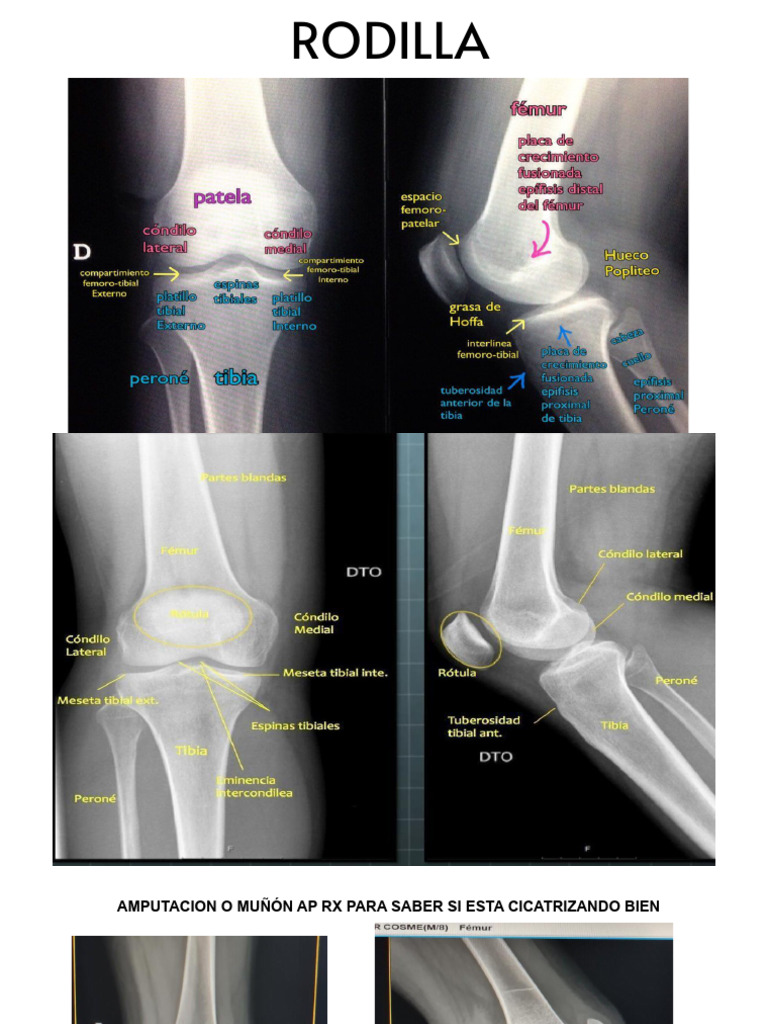 Trastornos y condiciones de rodilla y pie | PDF