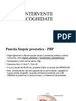 Adenocarcinomul de Prostata