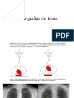 Radiografías apoyo de  torax (1)