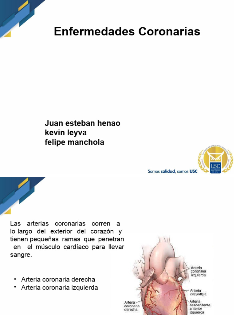 Enfermedades Coronarias: Causas y Tratamientos | PDF | Infarto de ...