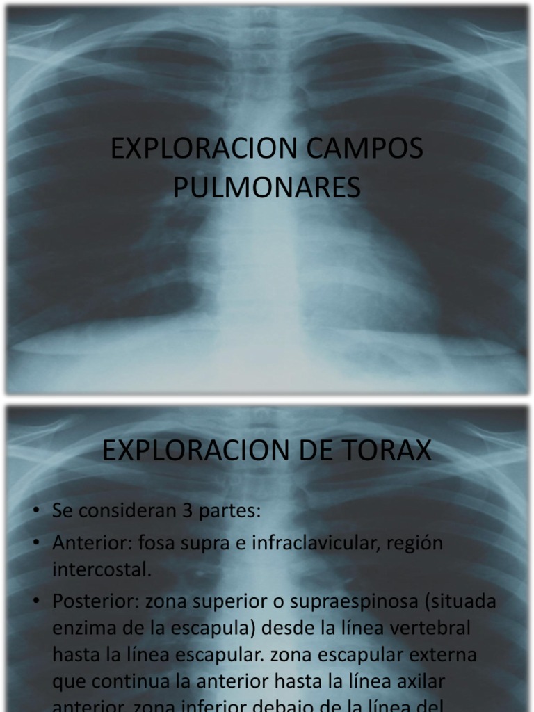 EXPLORACION_CAMPOS_PULMONARES