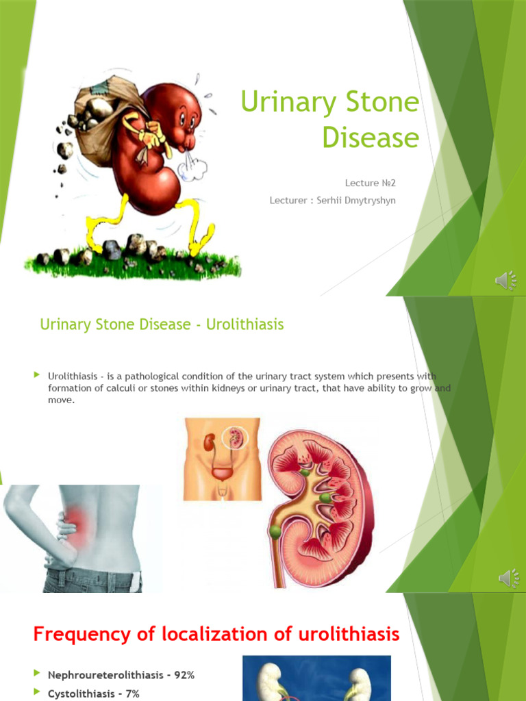 Urolithiasis PDF Urinary System Kidney