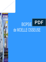 Biopsie de La Moelle Osseuse