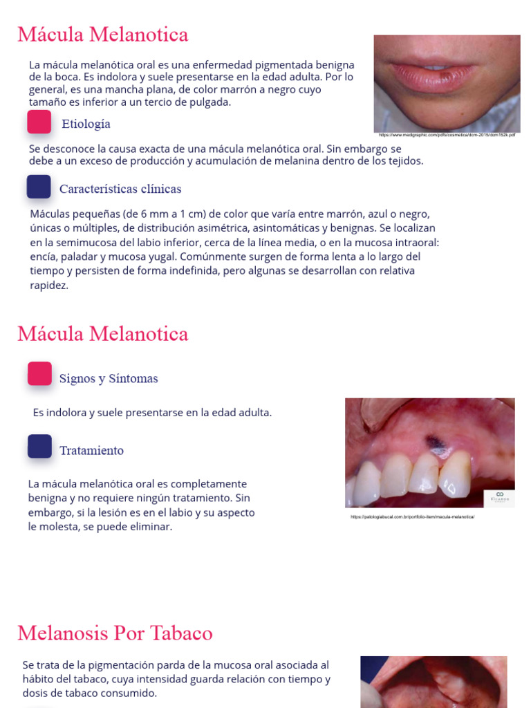 mácula melanótica labial causas Buy Melanotan-1 10mg Peptide | 99% Purity main image 1