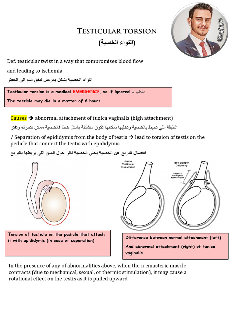 Testicular Torsion @mdinfos | PDF
