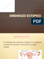 Embarazo Ectopico