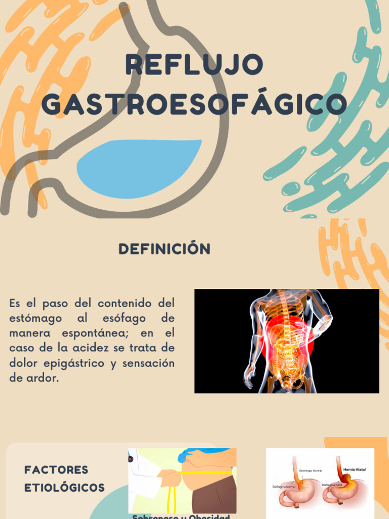 Reflujo Gastroesofágico | PDF