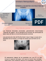 PX Con Fractura de Cadera