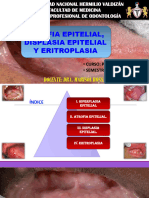 Semana 8 - Atrofia Epitelial, Displasia Epitelial y Eritroplasia