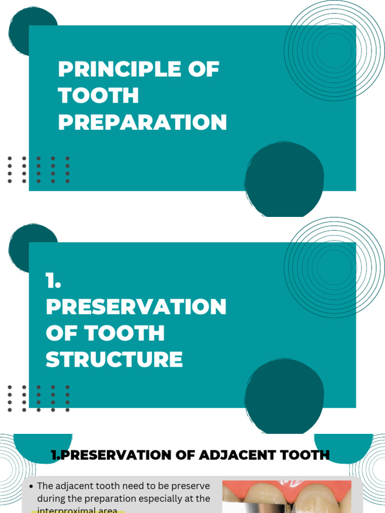 Seminar Principle Tooth Preparation PDF