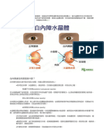 白內障是什麼？醫師帶你了解原因、症狀、治療到手術後保養