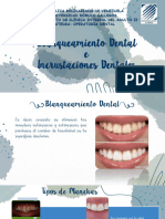 Blanqueamiento Dental e Incrustaciones Dentales