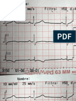 Trazo Ordinario EKG