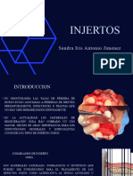 Injertos