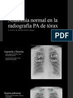 RX Tórax Normal y Patològica