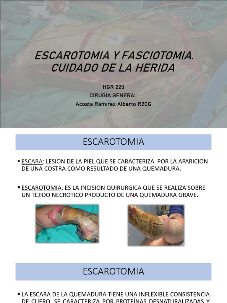 Escarectomias y Fasciotomias PDF
